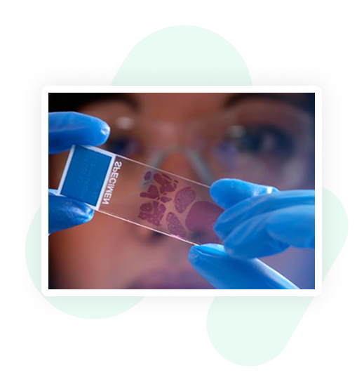 A doctor looking at a specimen